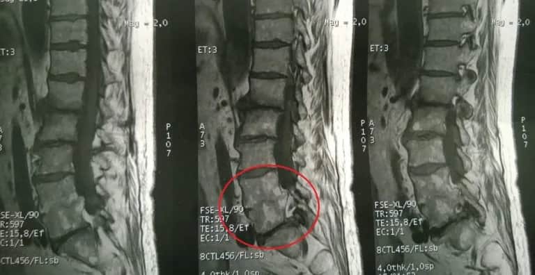 Ile trwa rezonans odcinka lędźwiowego? Poznaj czas i przebieg badania
